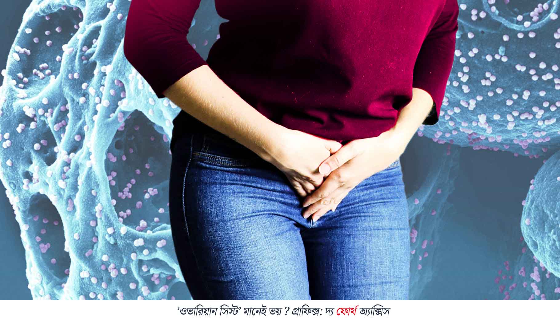 ‘ওভারিয়ান সিস্ট’ মানেই ভয় ? ভুল ধারণা ভাঙছে চিকিৎসাবিজ্ঞান