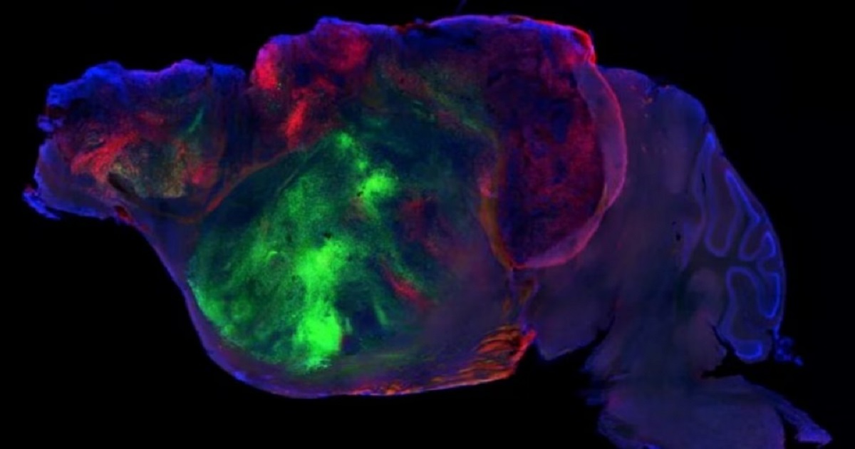 ইঁদুরের মস্তিষ্কে মানুষের মস্তিষ্কের কোষ!